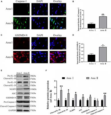 Targeting TFE3 Protects Against Lysosomal Malfunction-Induced Pyroptosis in Random Skin Flaps via ROS Elimination